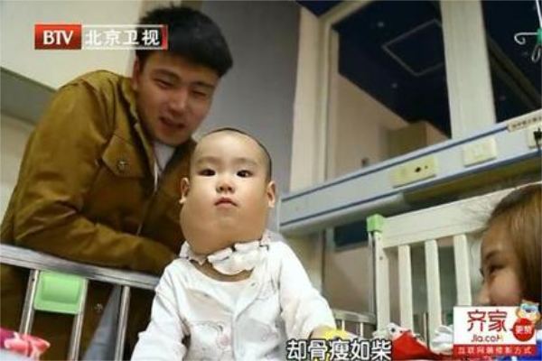 毒家居為何讓1歲半孩子染上怪病